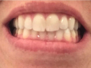 Toothpaste