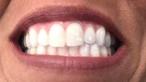 Toothpaste